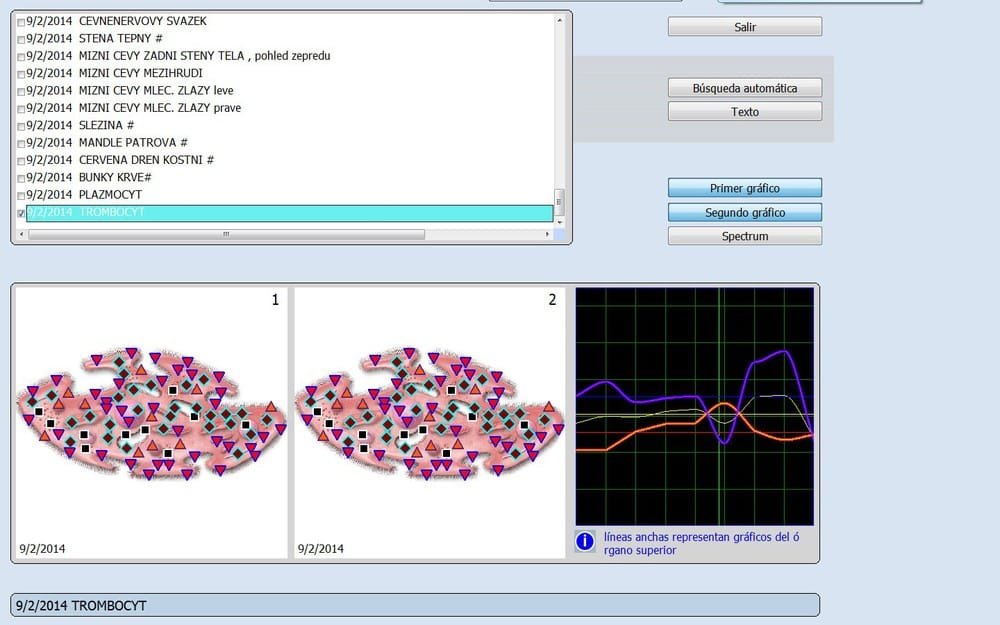 9d nls quantum health analyzer