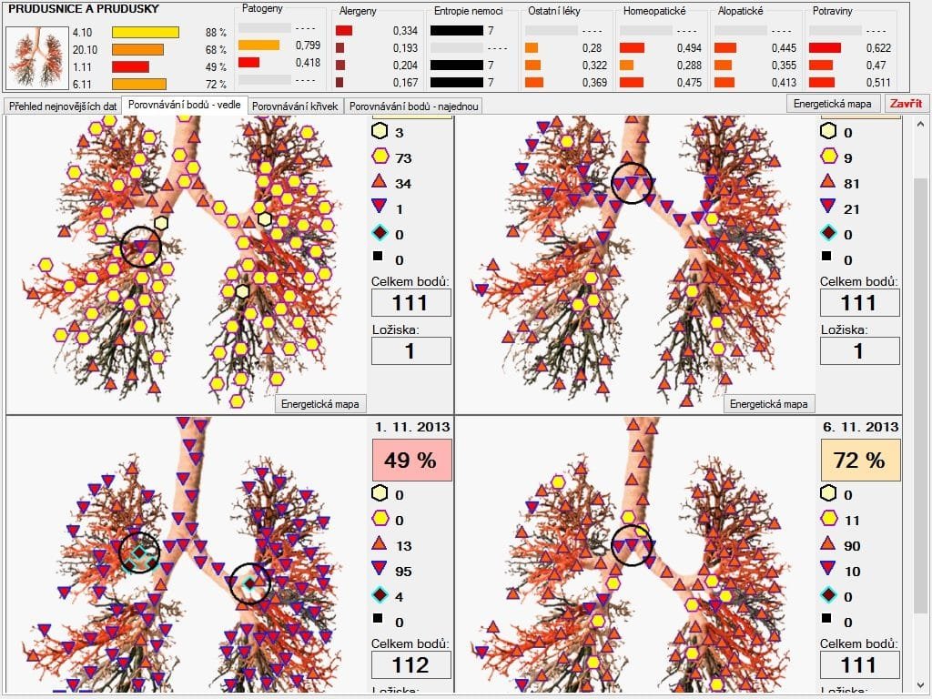 9d nls quantum health analyzer