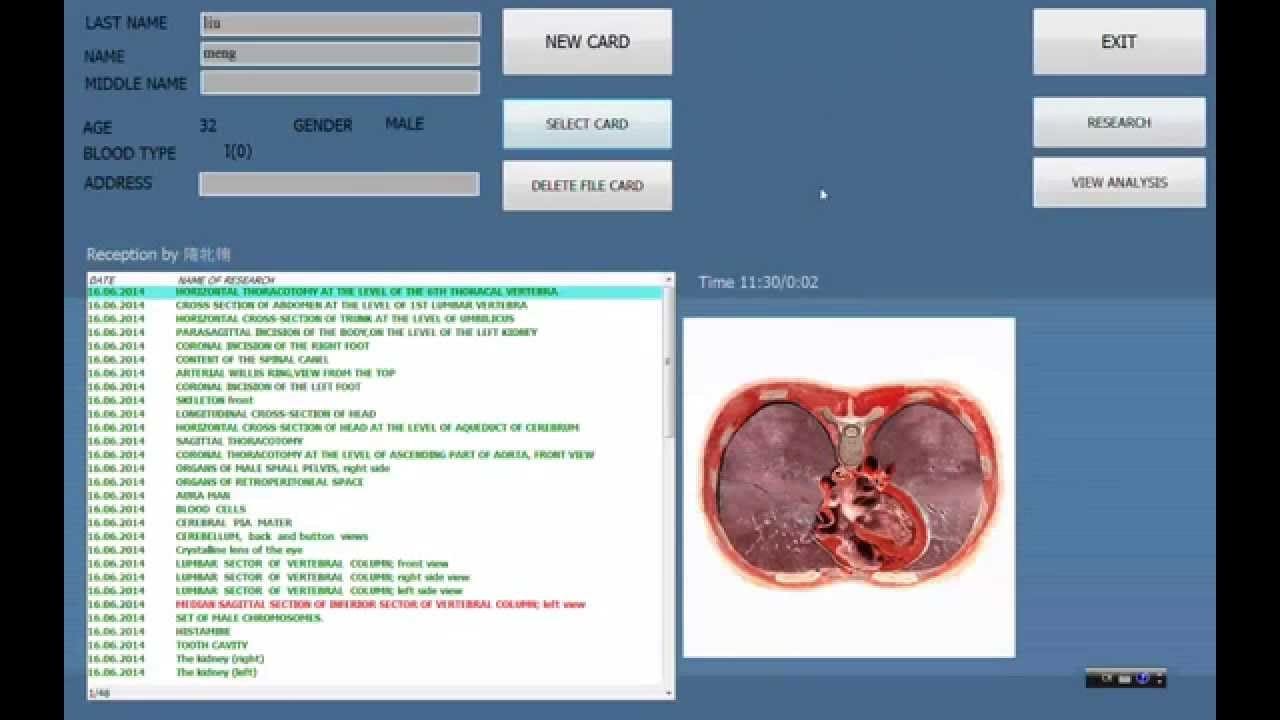 vector-nls diagnostika