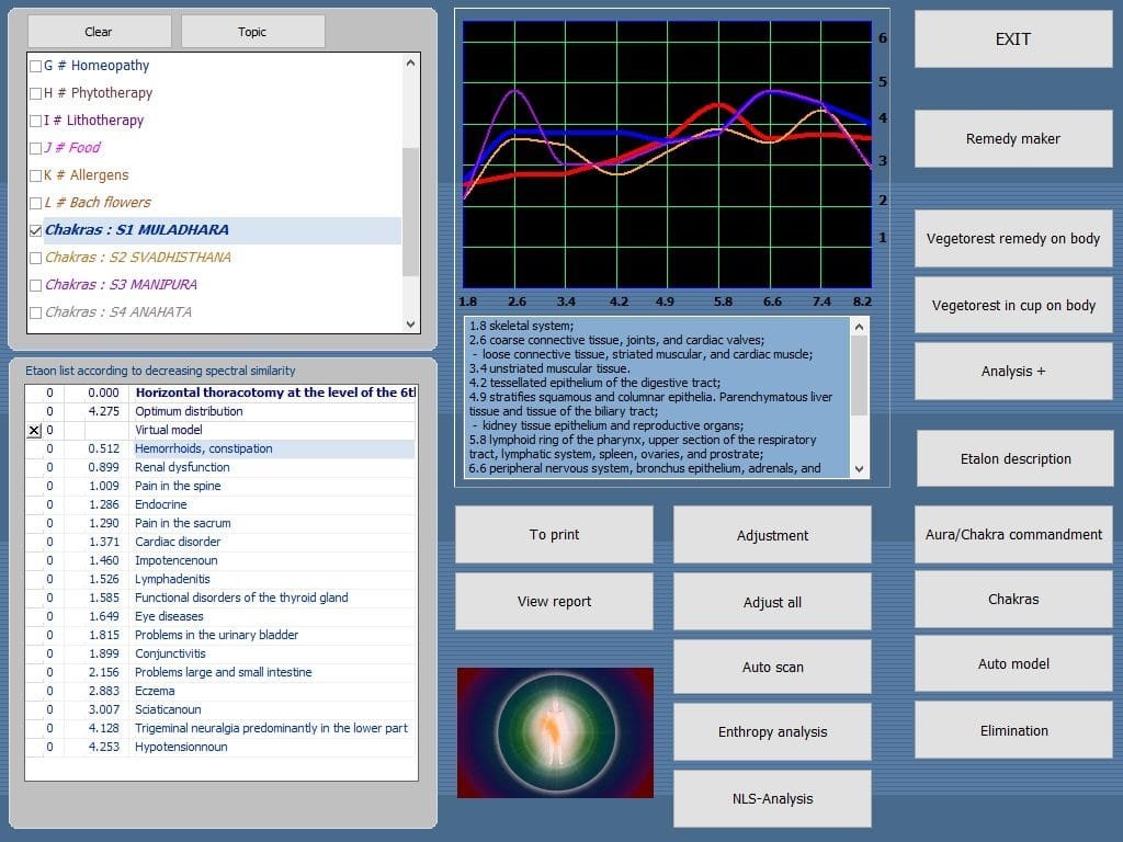 vector-nls diagnostika