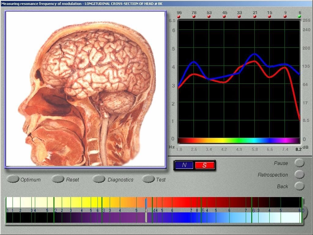 vector-nls diagnostika