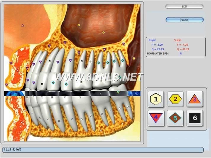 vector nls software