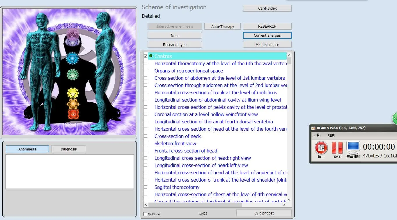 vector nls scan