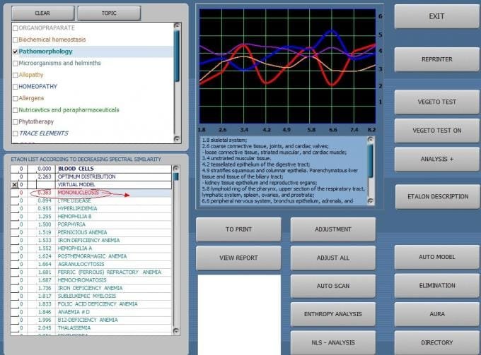 nls vecto rwhat it,how workwhat can do and price