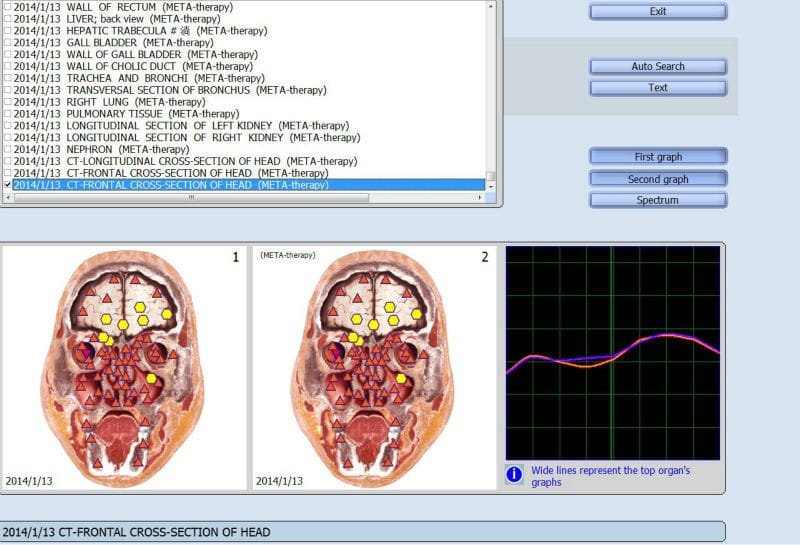 vector biofeedback