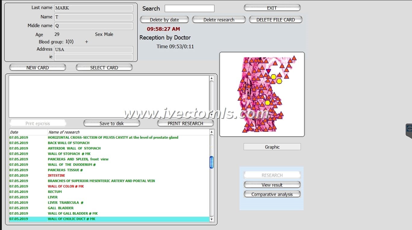 vector nls device what it,how work and what price