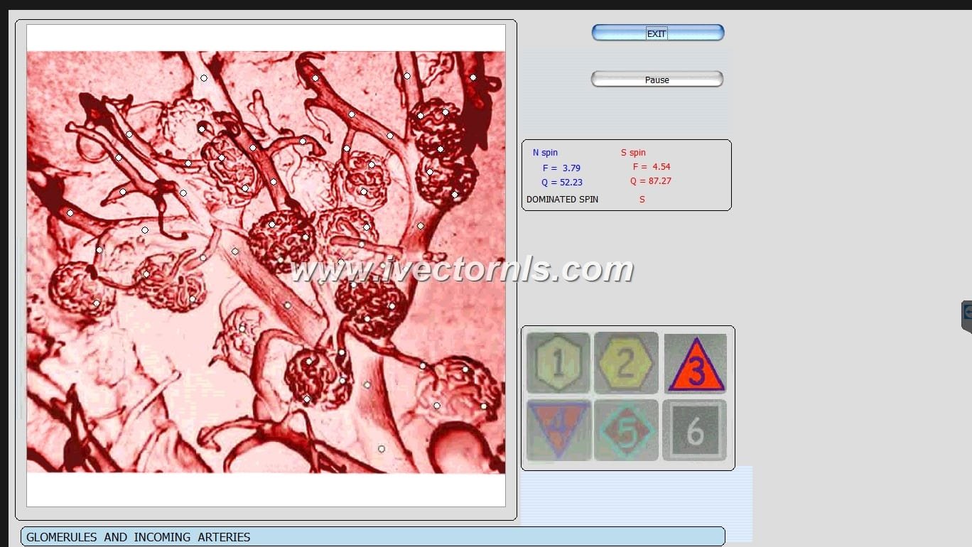 vector nls device what it,how work and what price