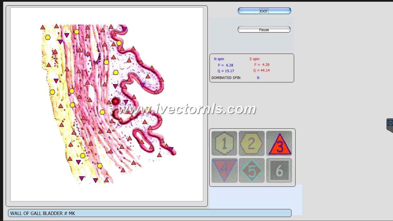 vector nls device what it,how work and what price