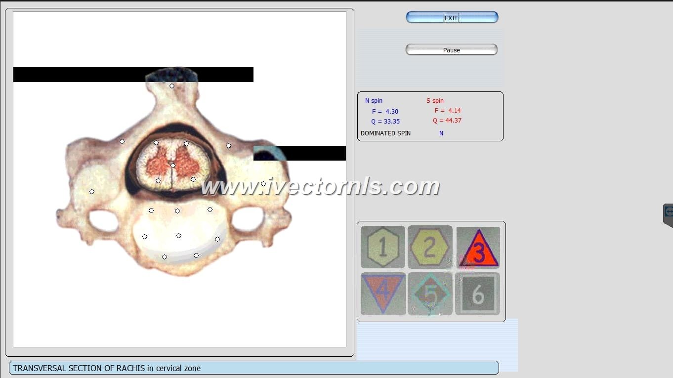 vector nls quantum biofield scanner