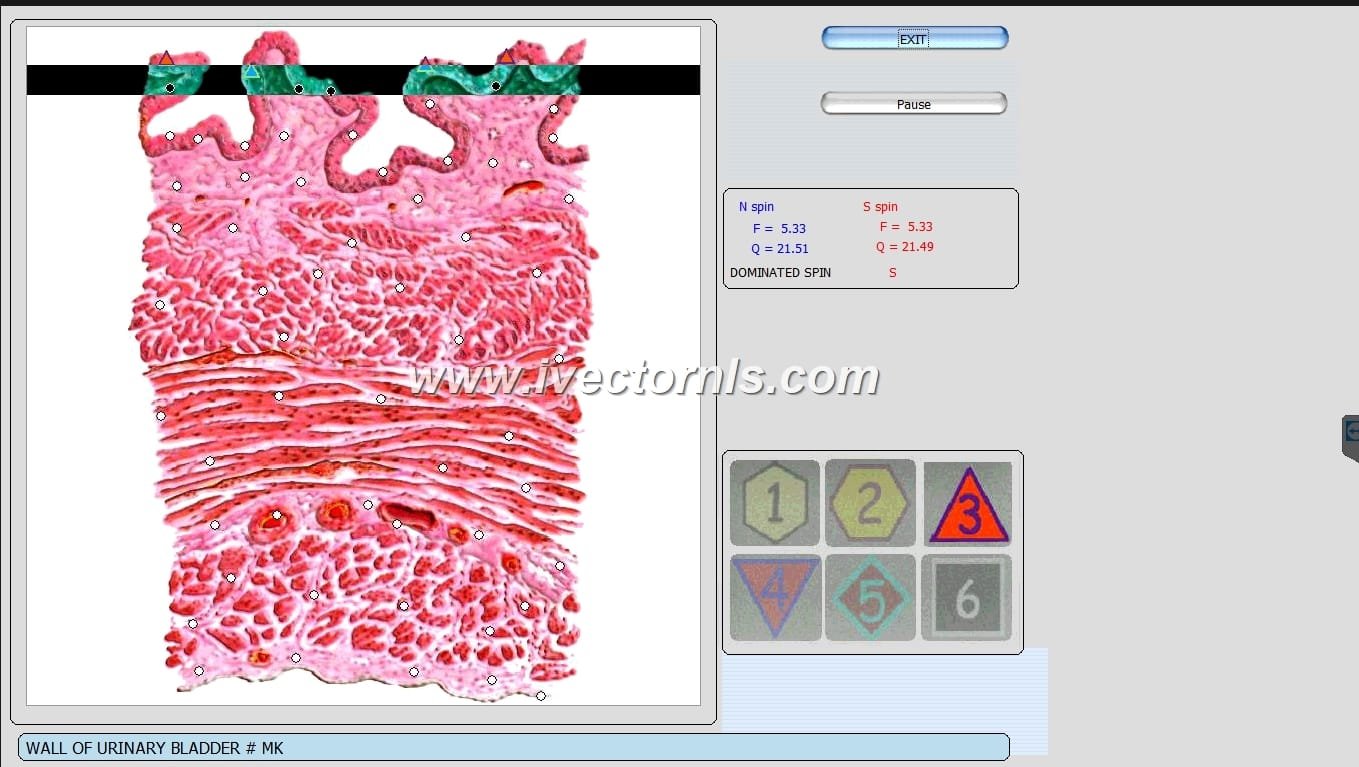 vector expert nls