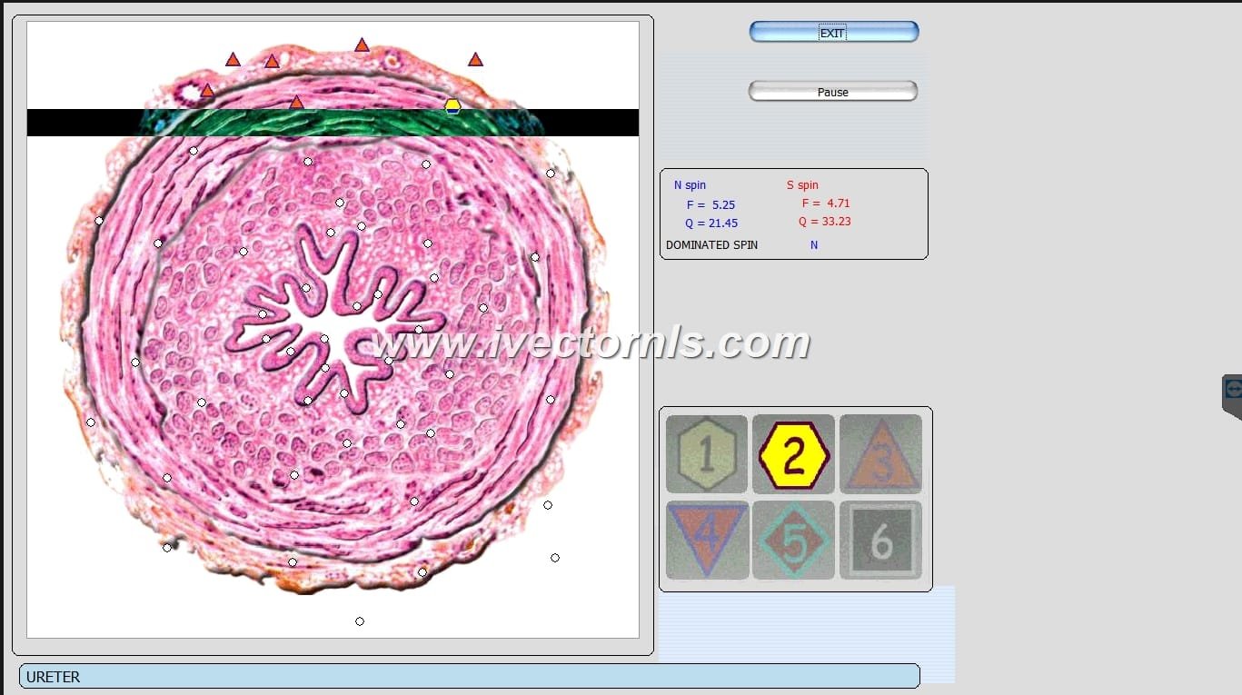 vector expert nls