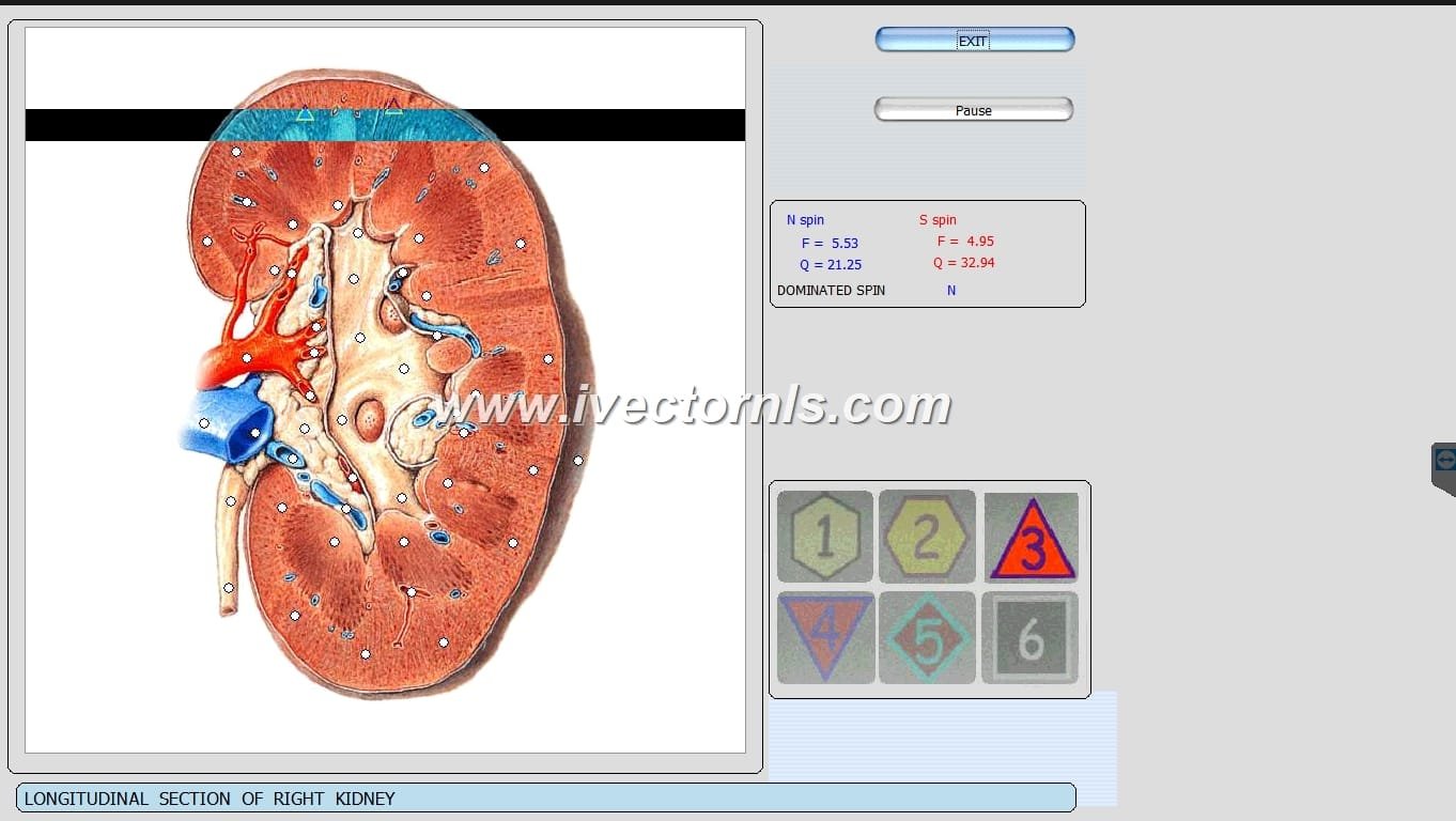 vector nls software