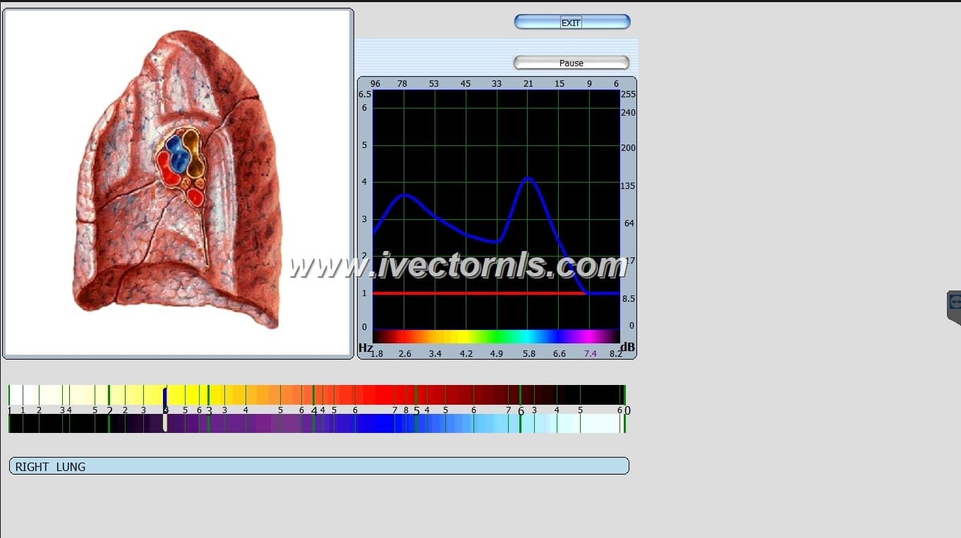 Oberon NLS Biofeedback