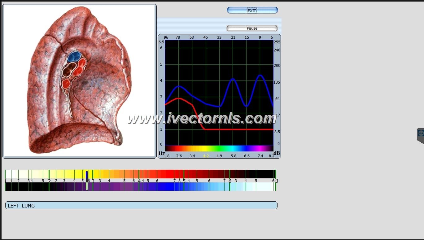 Oberon NLS Biofeedback