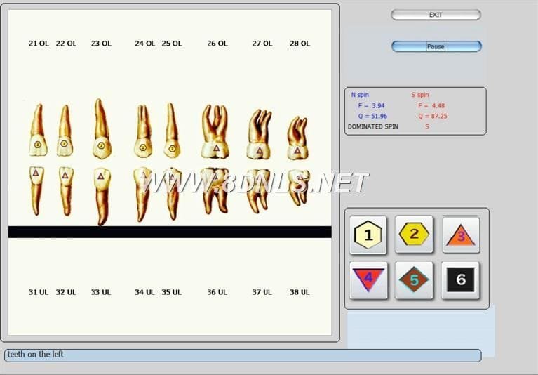 9D NLS Analyzer