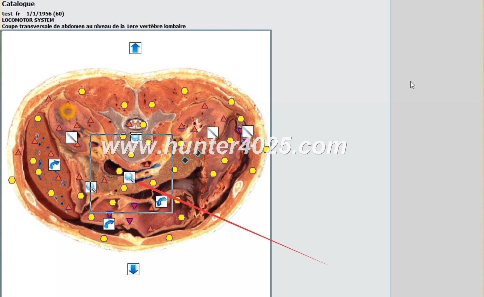 Metatron Hunter Rusia