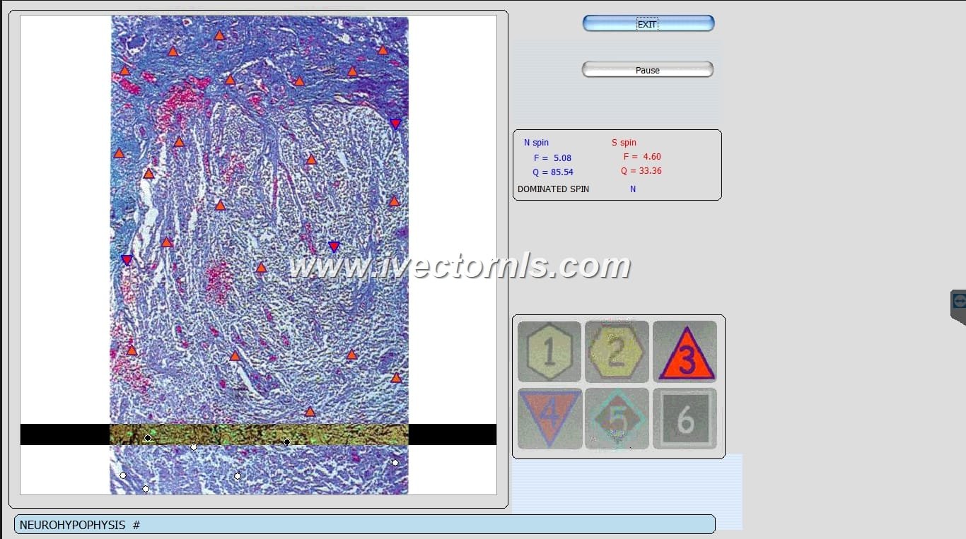 Metatron Clinical Price