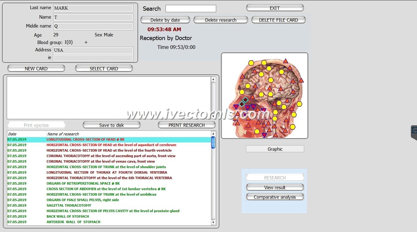 Metatron Clinical Price