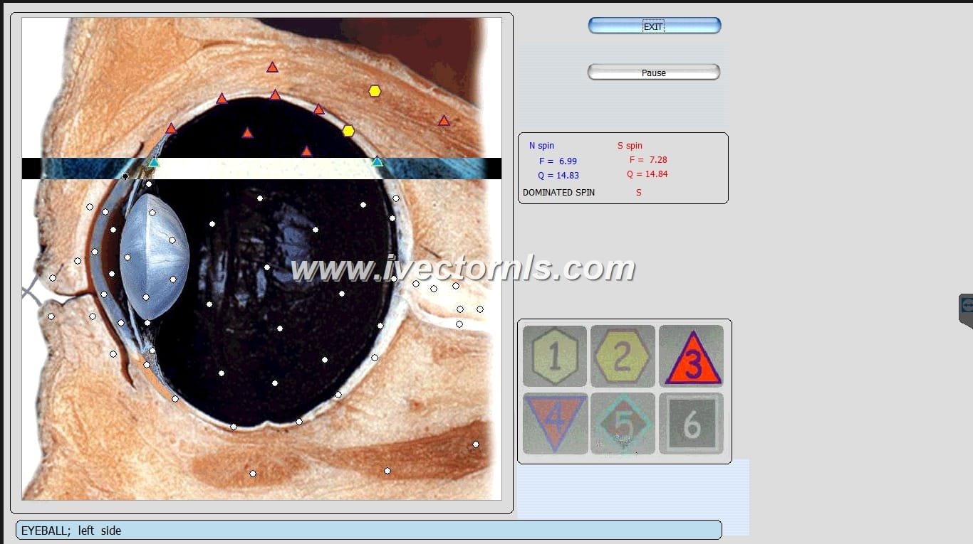 vector nls device what it,how work and what price